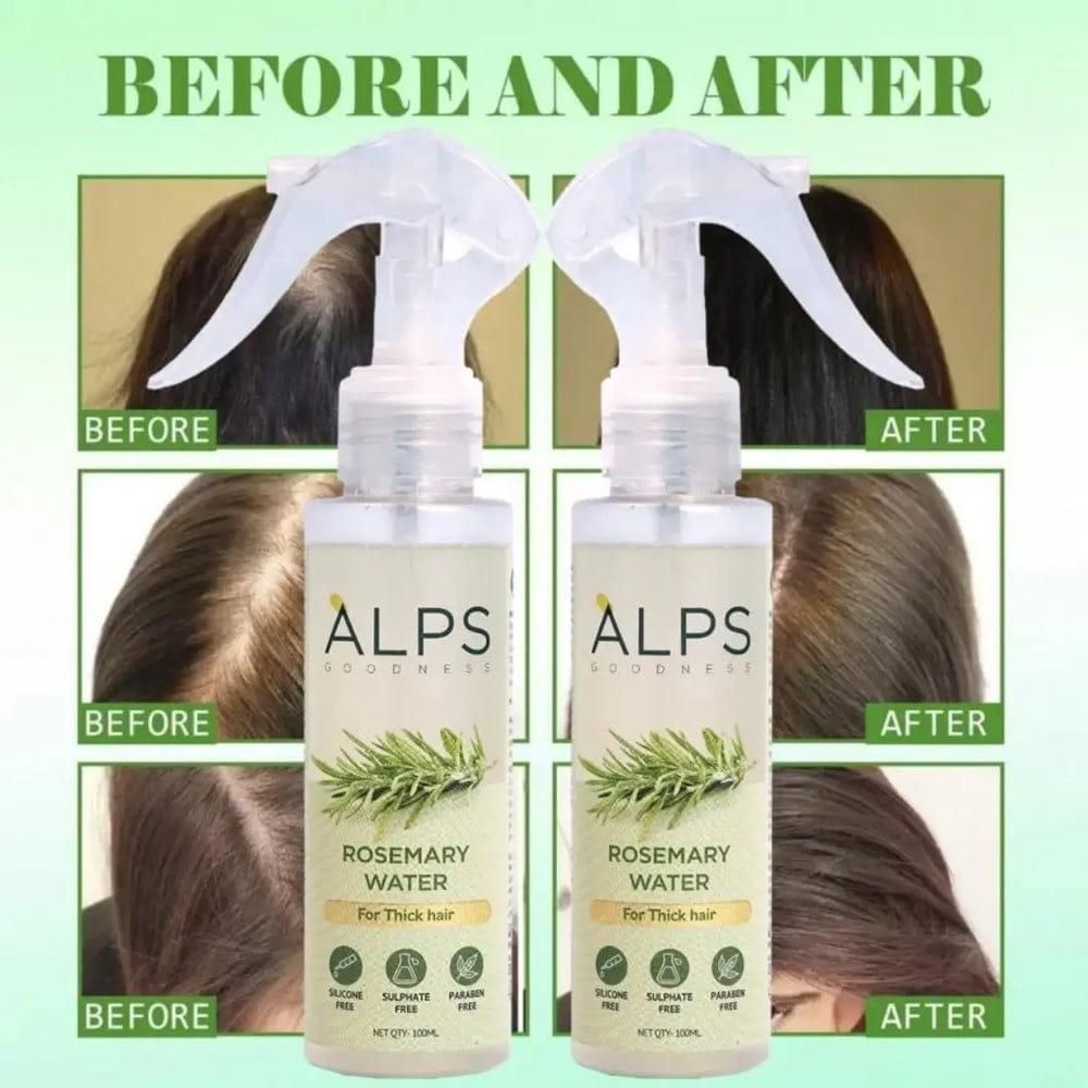 ALPS ROSEMARY WATER , – Buy 1 Get 2 FREE! , ✅ Get 5% EXTRA OFF !(Use Code:"WELCOME5")